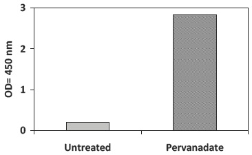 PEL-TYK2-Y-Pervanadate Stimulation of Jurkat Cell Line