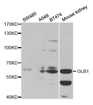 Western blot - GLB1 antibody (144-01863)