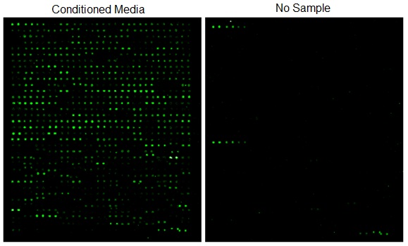 Glycosylation-Array Glycosylation Antibody Array