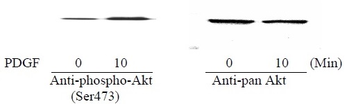 AKT (S473) - Western Blot