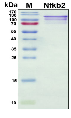 SDS-PAGE