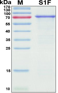 SDS-PAGE