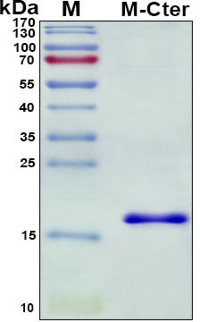 SDS-PAGE