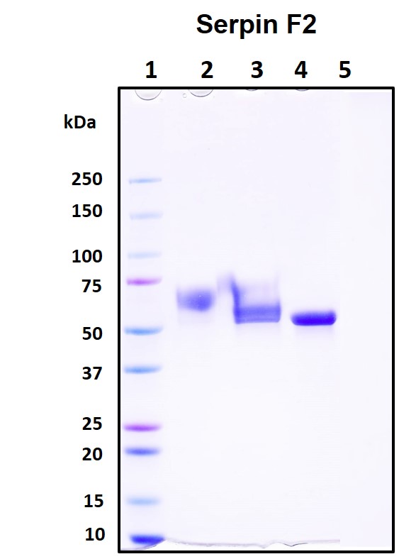 SDS-PAGE
