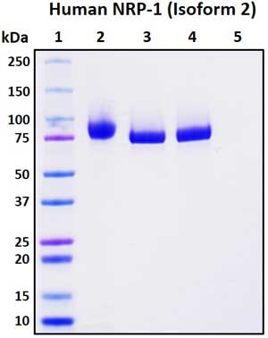 SDS-PAGE