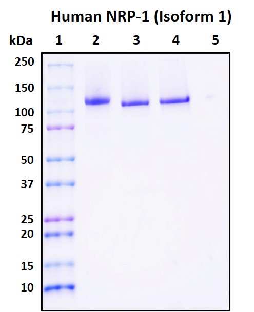 SDS-PAGE