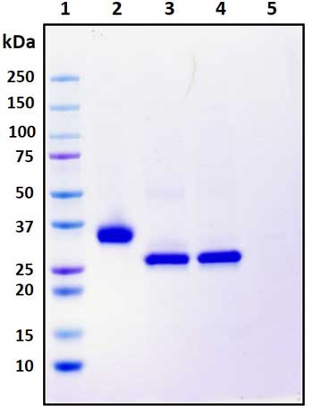 SDS-PAGE