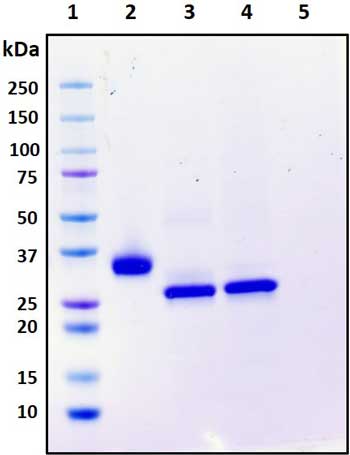 SDS-PAGE