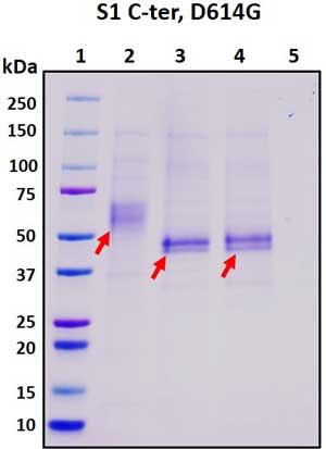 SDS-PAGE