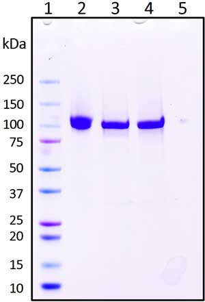 SDS-PAGE
