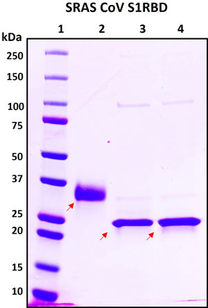 SDS-PAGE