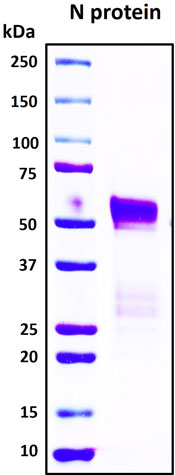 SDS-PAGE