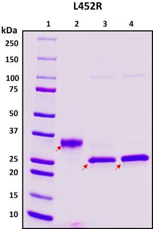 SDS-PAGE