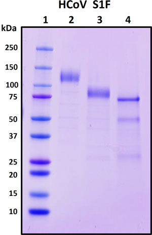 SDS-PAGE