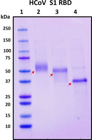 SDS-PAGE