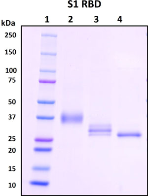 SDS-PAGE
