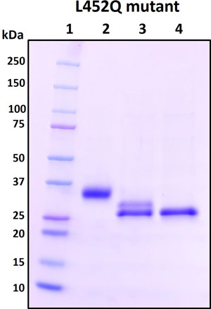 SDS-PAGE