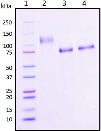 SDS-PAGE