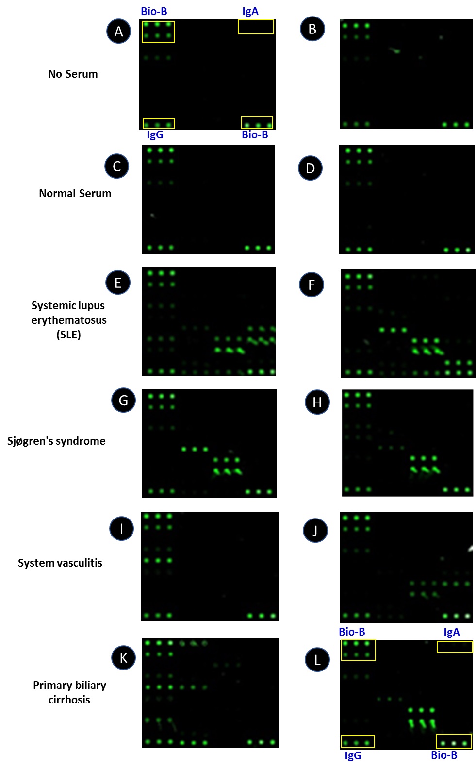 Typical result using serum on the RayBio<sup>®</sup> Autoimmune Disease IgG Autoantibody Detection Array.