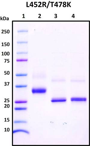 SDS-PAGE