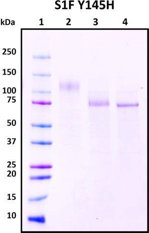 SDS-PAGE