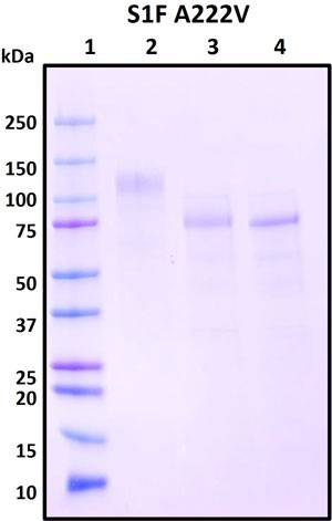 SDS-PAGE