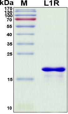 SDS-PAGE