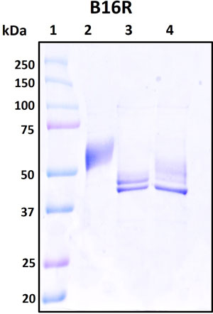 SDS-PAGE