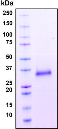 SDS-PAGE