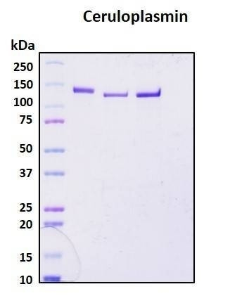 Recombinant Human Ceruloplasmin Protein