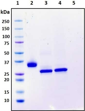 Recombinant SARS-CoV-2 S1 Subunit Protein (RBD), mutant Y453F, Biotinylated