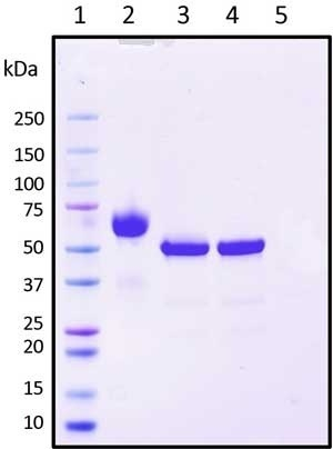 Recombinant Human AXL Receptor Tyrosine Kinase (extracellular) Protein, Biotinylated