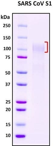 Recombinant SARS-CoV S1 Subunit Protein, full length, Biotinylated