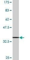 Anti-ABCB9 Antibody