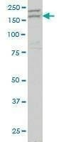 Anti-AATK Antibody