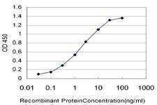 Anti-ABCC6 Antibody