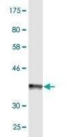 Anti-ABCB6 Antibody