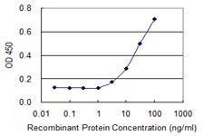Anti-ABCA10 Antibody