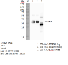Anti-SARS-CoV-2 S1 RBD Antibody