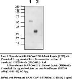 Anti-SARS-COV-2-S1RBD Antibody
