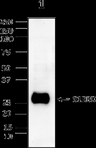 Anti-SARS-COV-2-S1RBD Antibody