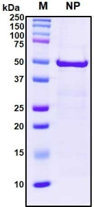 Recombinant SARS-CoV-2 Nucleocapsid Protein