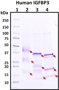 Recombinant Human IGFBP-3 Protein, HEK293