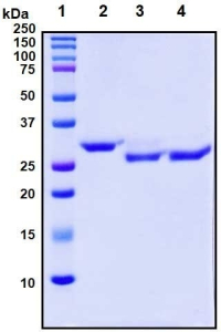 Recombinant SARS-CoV-2 S1 Subunit Protein (RBD), mutant N331Q, Biotinylated