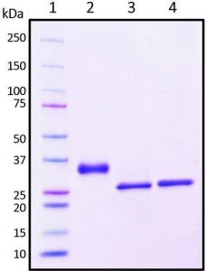 Recombinant SARS-CoV-2 S1 Subunit Protein RBD, R346K mutant, Biotinylated
