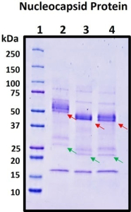Recombinant SARS-CoV-2 Omicron Variant B.1.1.529 Nucleocapsid (N) Protein