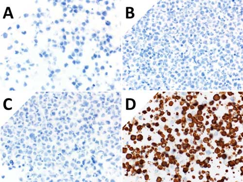 ihc-controls-analysis ihc-controls-analysis