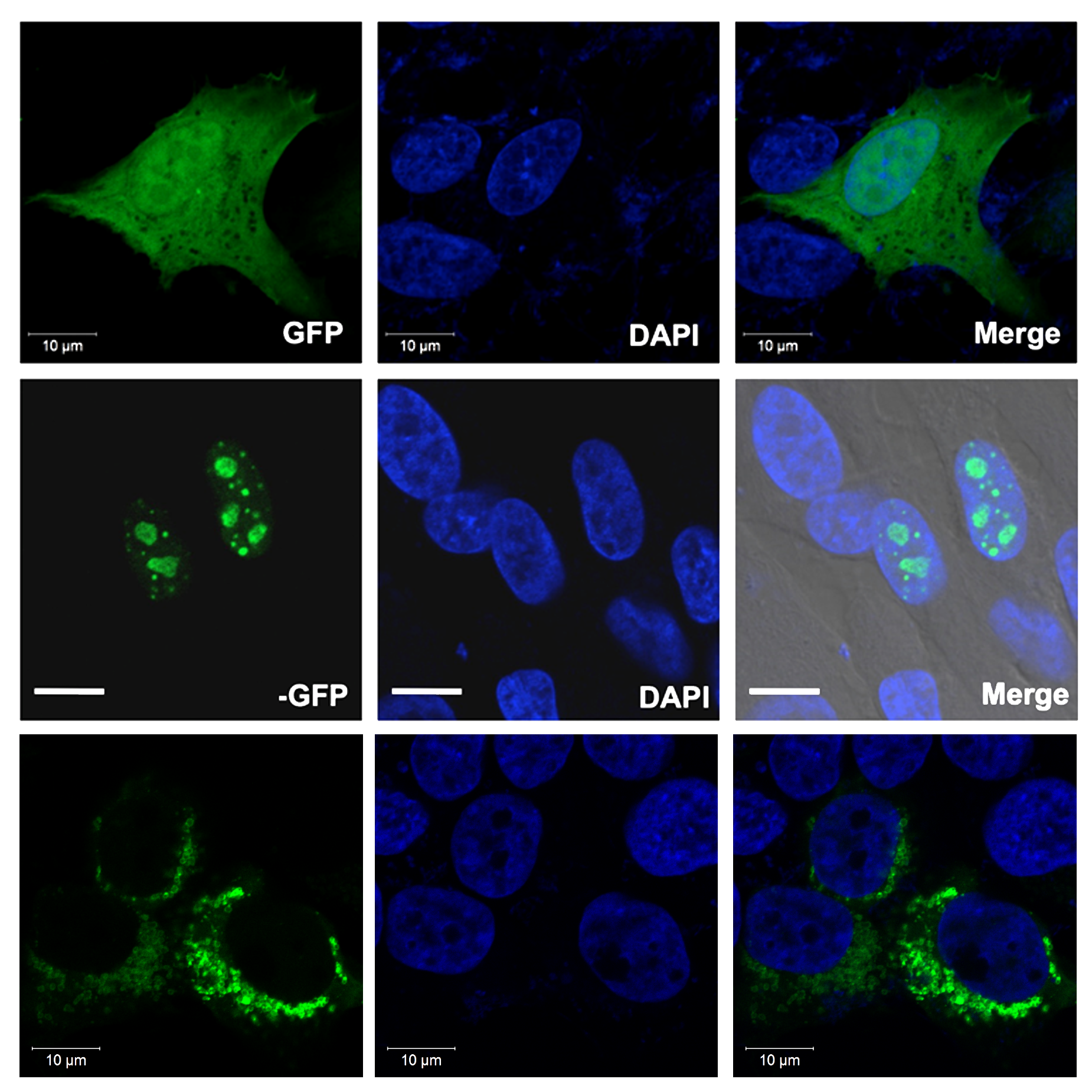 stable-cell-line-generation-gfp-fusion Cell images using a GFP filter, DAPI filter, and merged