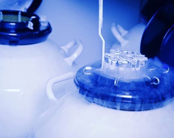Biospecimen Samples & Sample Services