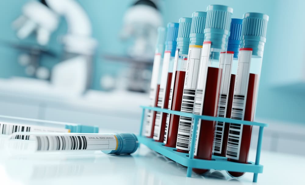 blood_samples blood_samples